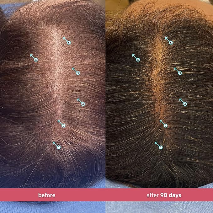 DS Labs Spectral Women's Formally Spectral.CSF - Hair Density Serum for Women, Thickening, Strengthening, Volumizing, Fuller-Looking Hair, 60mL, Packaging May Vary