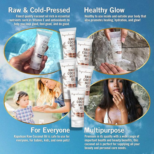 Coconut Oil for Hair, Skin - Extra Virgin Cold Pressed Oil with MCTs for Body Care or Haircare, Hair Growth, Aceite de Coco Natural, Baby, Dogs, Pets Travel Mini Tube (5 x 25ml)