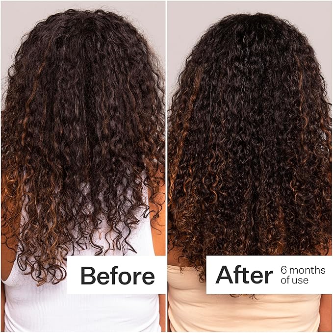 ACT+ ACRE Cold Processed Stem Cell Scalp Serum - Promotes Thicker and Fuller-Looking Hair - Soothes and Hydrates the Scalp - Sulphate and Paraben Free - Aloe Vera for Improved Scalp Health - 1 fl oz.