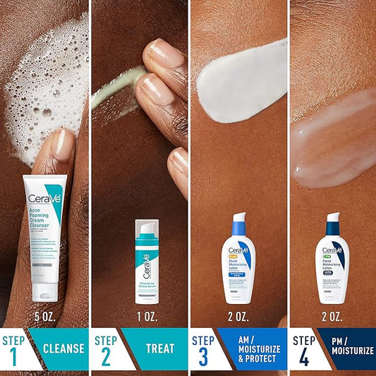 CeraVe Acne Skin Care Set, 5oz Acne Foaming Cream Cleanser + 1oz Resurfacing Retinol Serum + 2oz AM Facial Moisturizing Lotion with SPF 30 + 2oz PM Facial Moisturizing Lotion