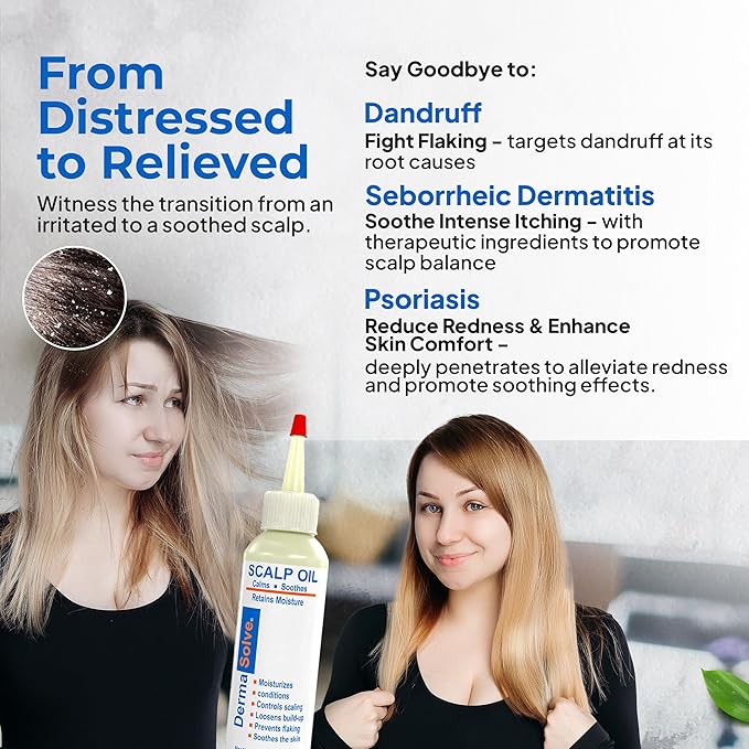 Dermasolve Psoriasis & Dandruff Oil, Dermatologist Approved for Flaky Scalp Relief