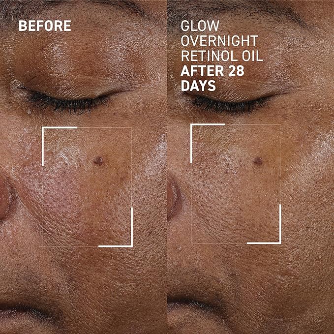 Dr. Brandt Bright This Way Glow Overnight Retinol Oil - Pure 2% Retinol Improves Wrinkles, Lines & Skin Texture - 1 fl oz